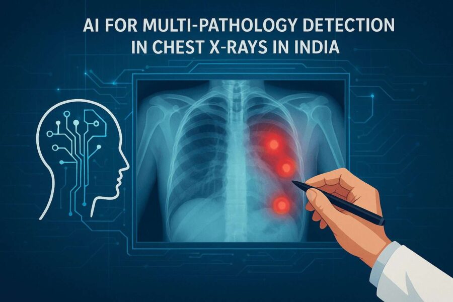 AI for Multi-Pathology Detection in Chest X-Rays in India